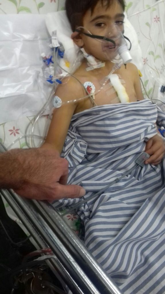Omar, a 7-year-old child refugee, underwent surgery in India for his heart condition