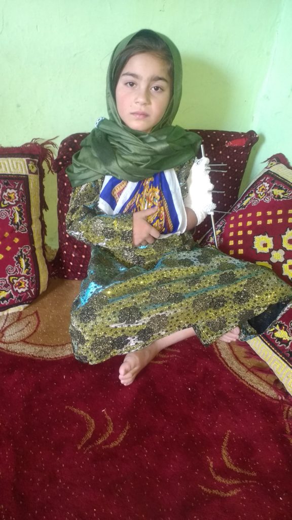Ganjeena is recovering and her upper left arm operation was successful at Avista Hospital in Kabul.